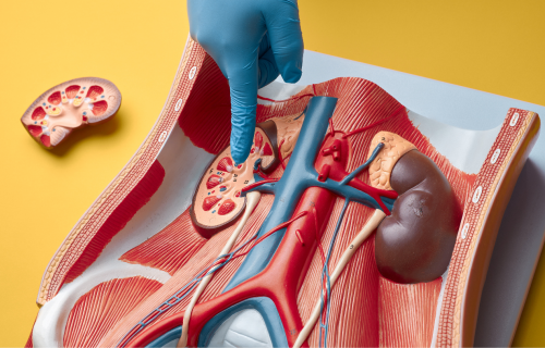 Transplante Renal